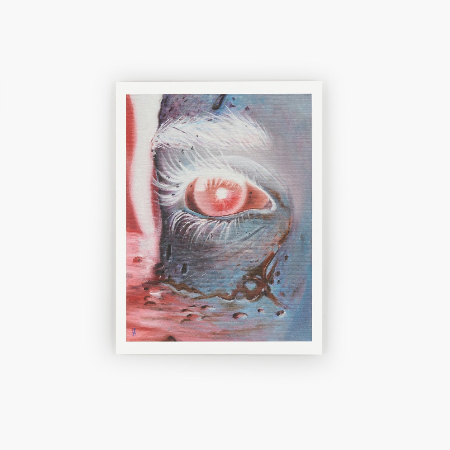 Watery Eye