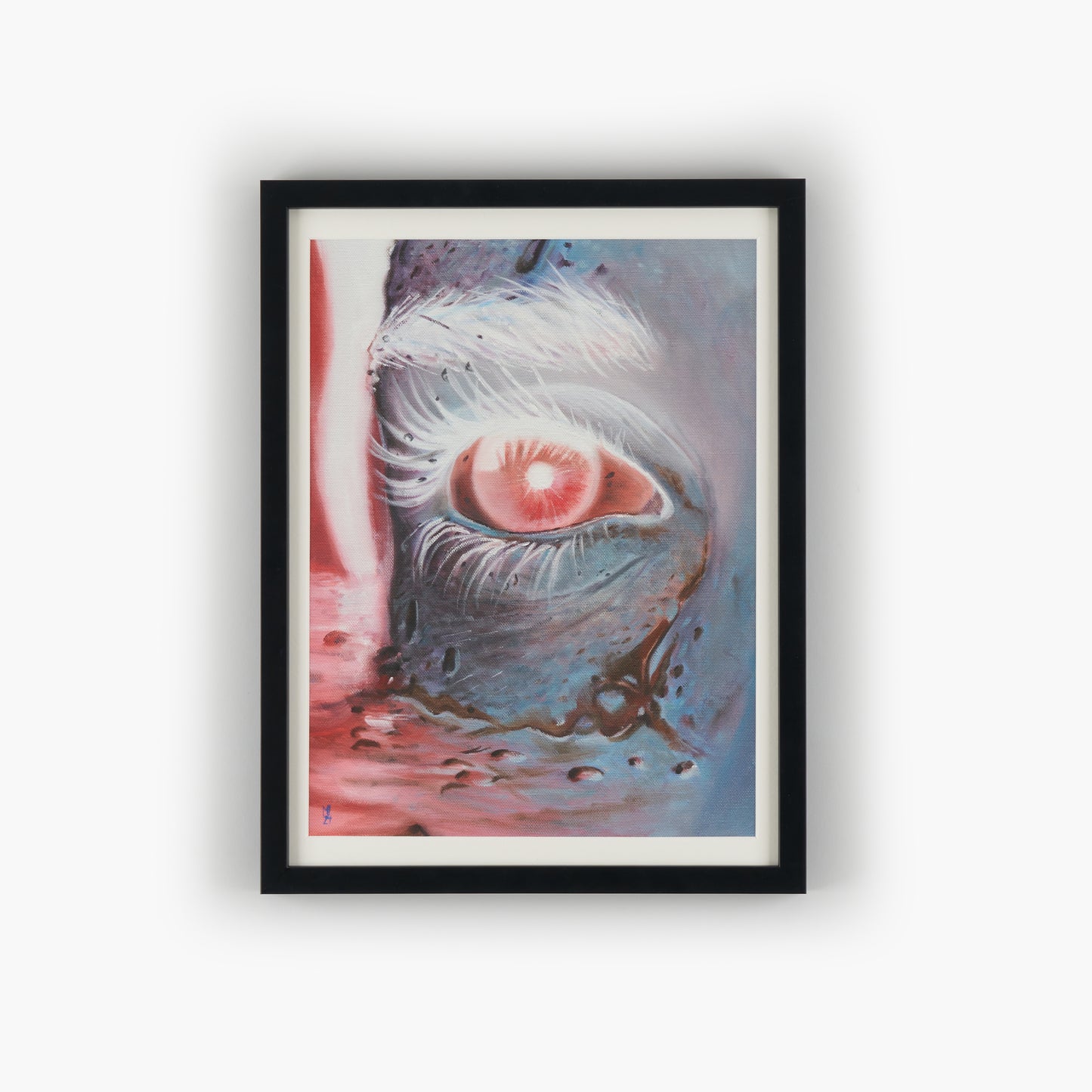 Watery Eye