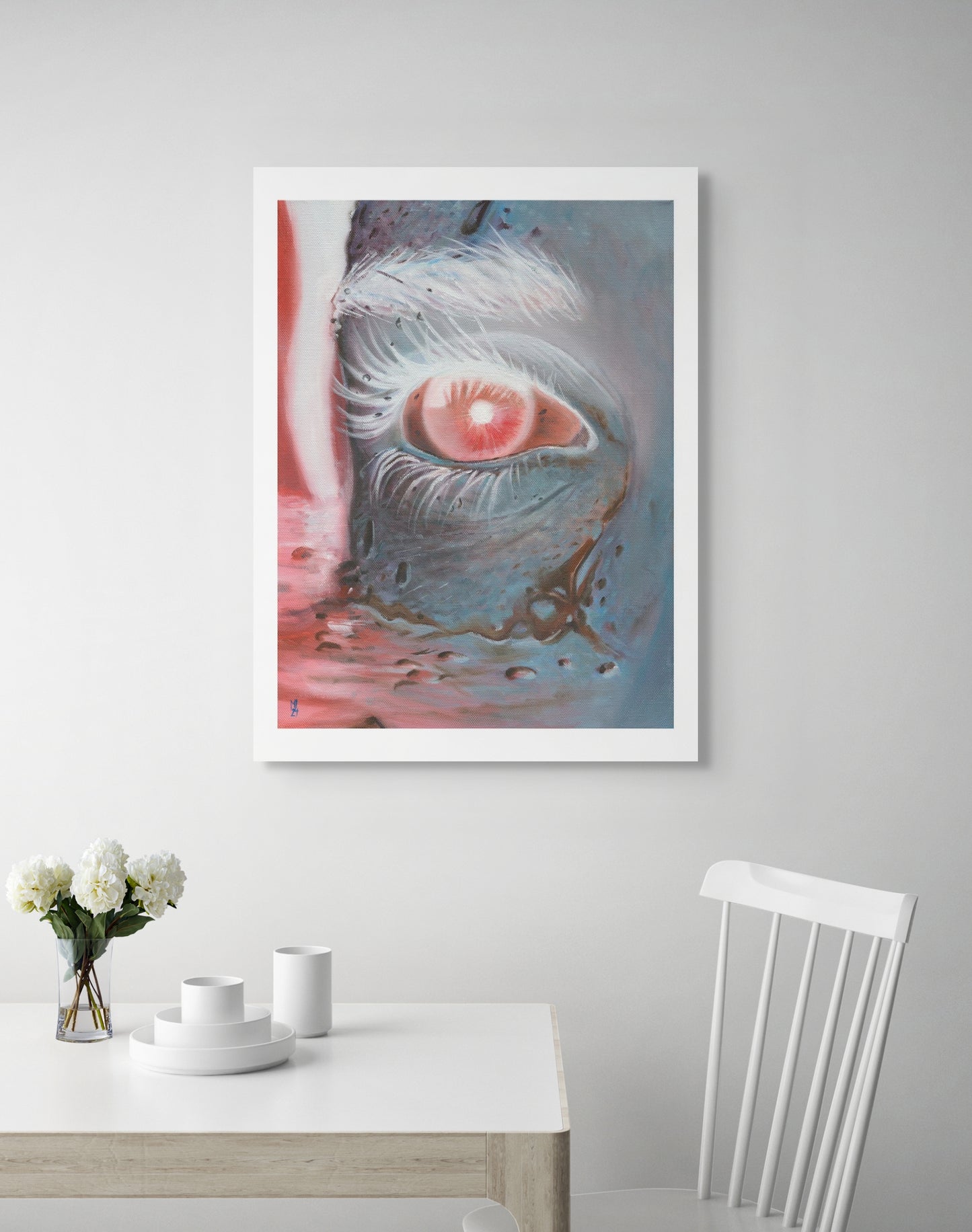 Watery Eye